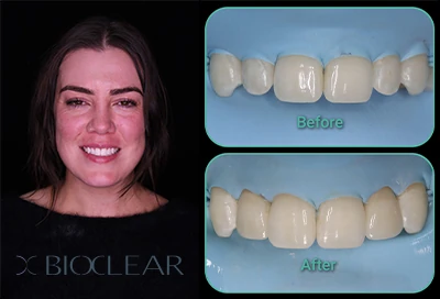 cosmetic dentistry Roseville, CA